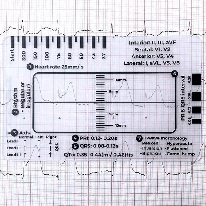 MediTrack – Professional ECG Assessment Pocket Guide