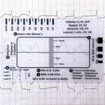 MediTrack – Professional ECG Assessment Pocket Guide