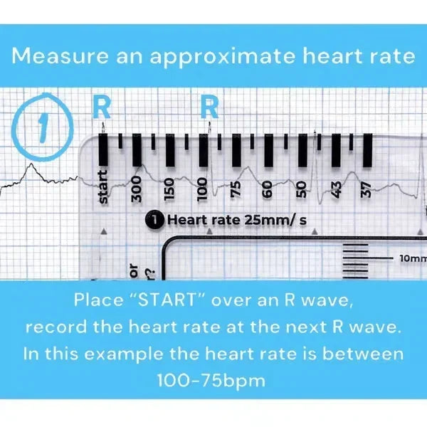 MediTrack – Professional ECG Assessment Pocket Guide