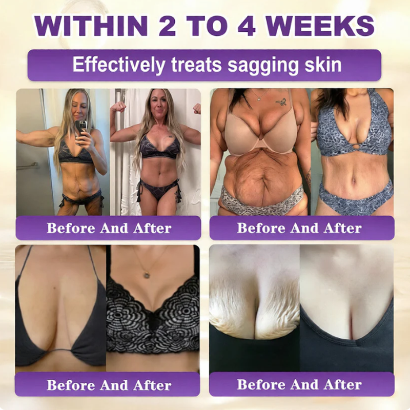 SkinRevive – Biotin 10-in-1 Skin Restoration Cream