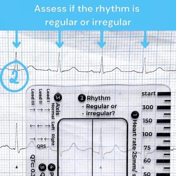MediTrack – Professional ECG Assessment Pocket Guide