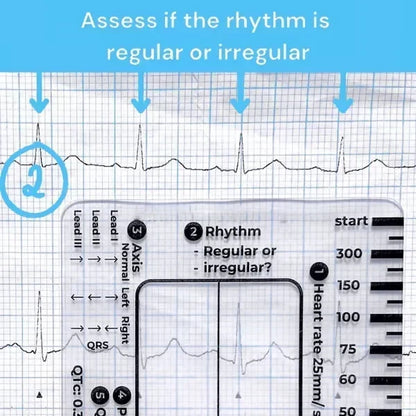 MediTrack – Professional ECG Assessment Pocket Guide