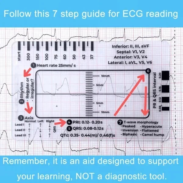 MediTrack – Professional ECG Assessment Pocket Guide