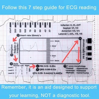 MediTrack – Professional ECG Assessment Pocket Guide