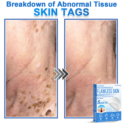GlowSkin - 2-in-1 Microneedle & Hydrocolloid Star Patch
