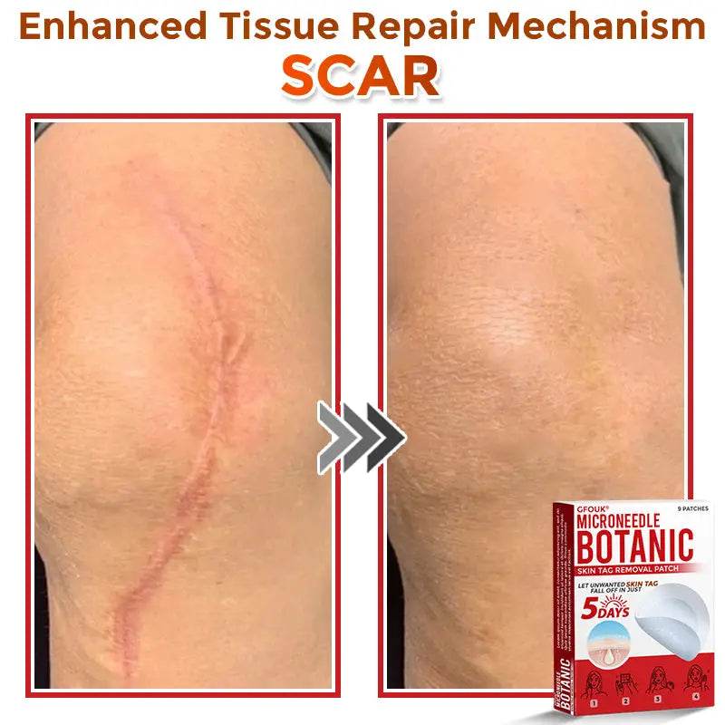 Natrvor –2-in-1 Microneedle Botanical Skin Renewal Patch