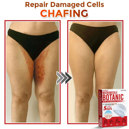 Natrvor –2-in-1 Microneedle Botanical Skin Renewal Patch
